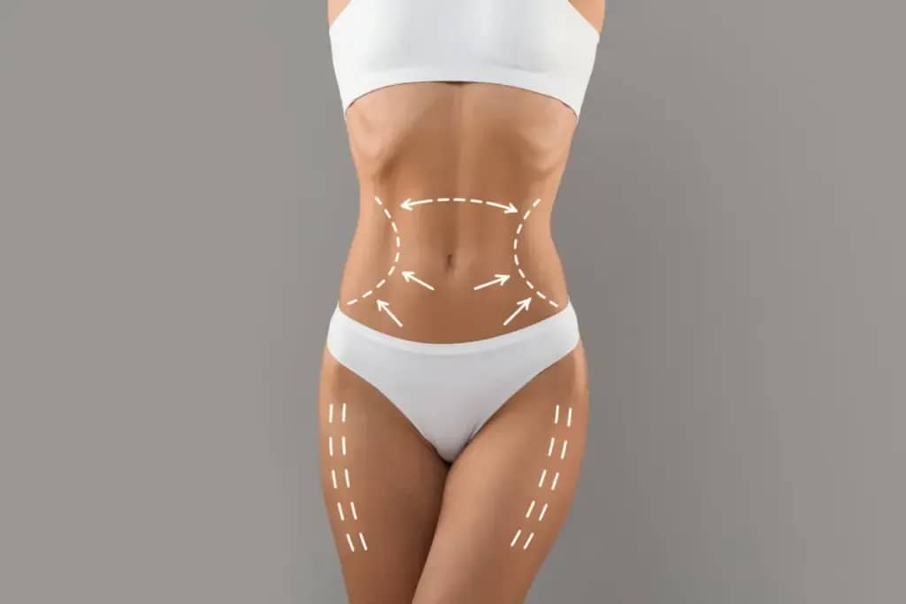 Top body sculpting experts