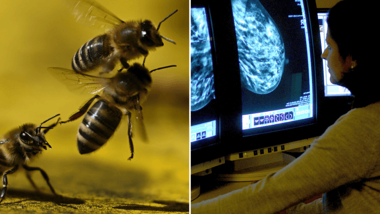 Bee Venom Kills Breast Cancer Cells in Under an Hour