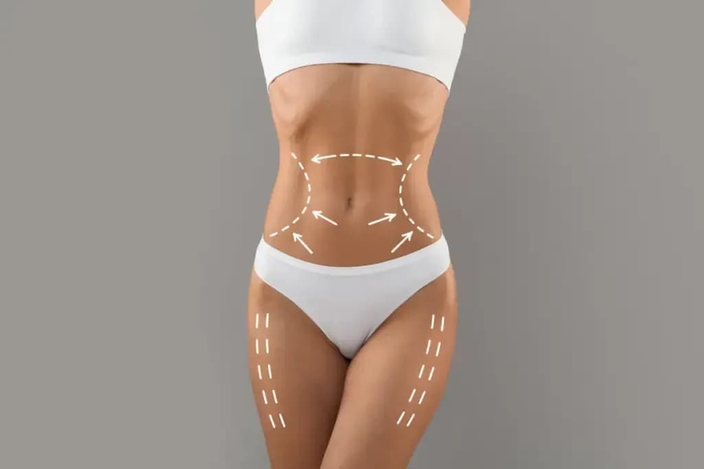 Top body sculpting experts