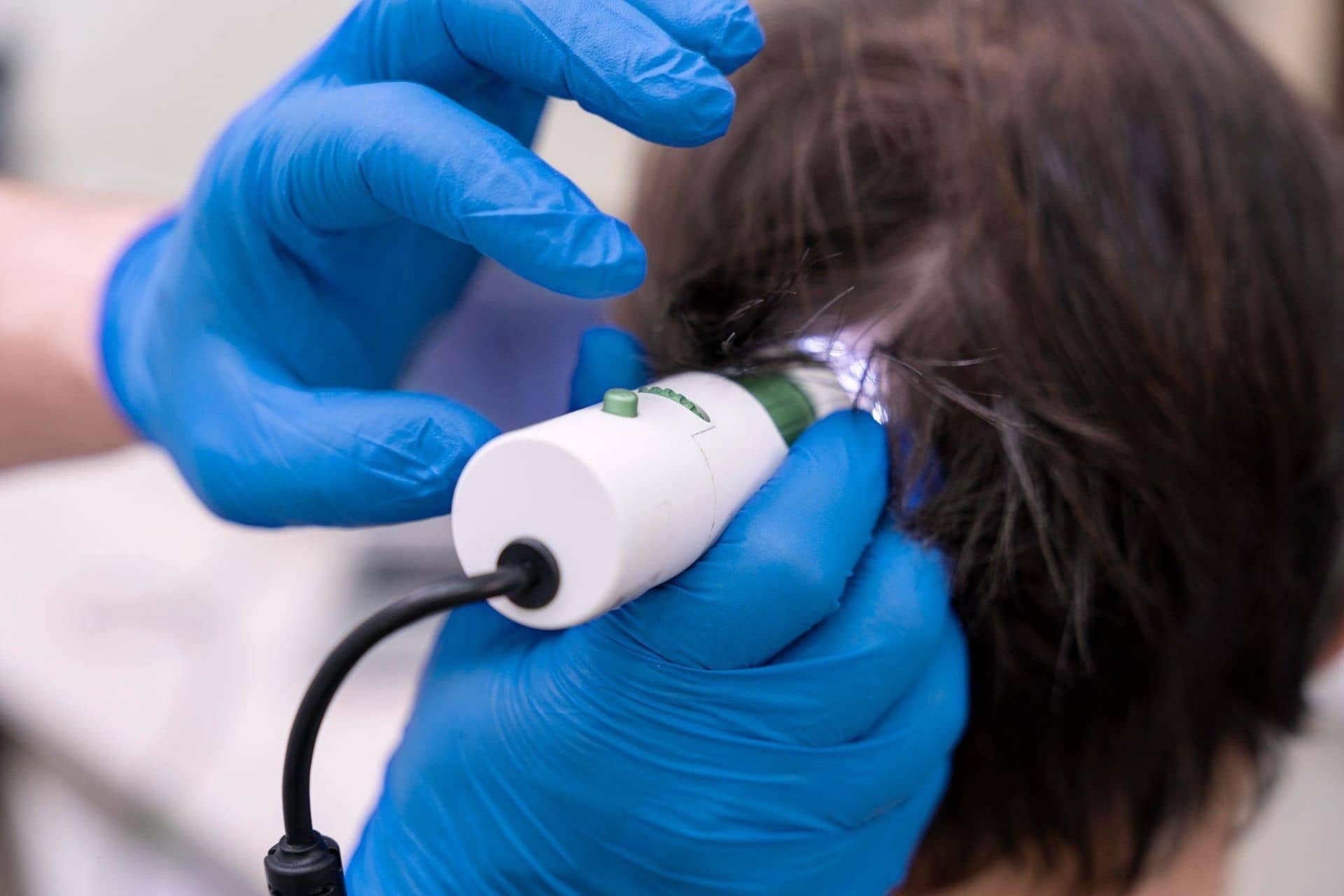 Diagnostic tools for hair loss treatment in India