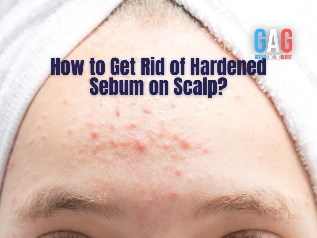 How to Get Rid of Hardened Sebum on Scalp?