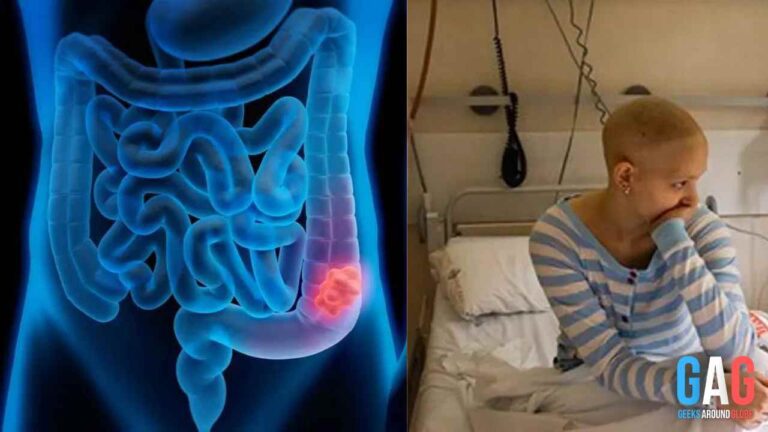 Young Americans at Risk | Rising Colon Cancer Cases Leave experts shocked