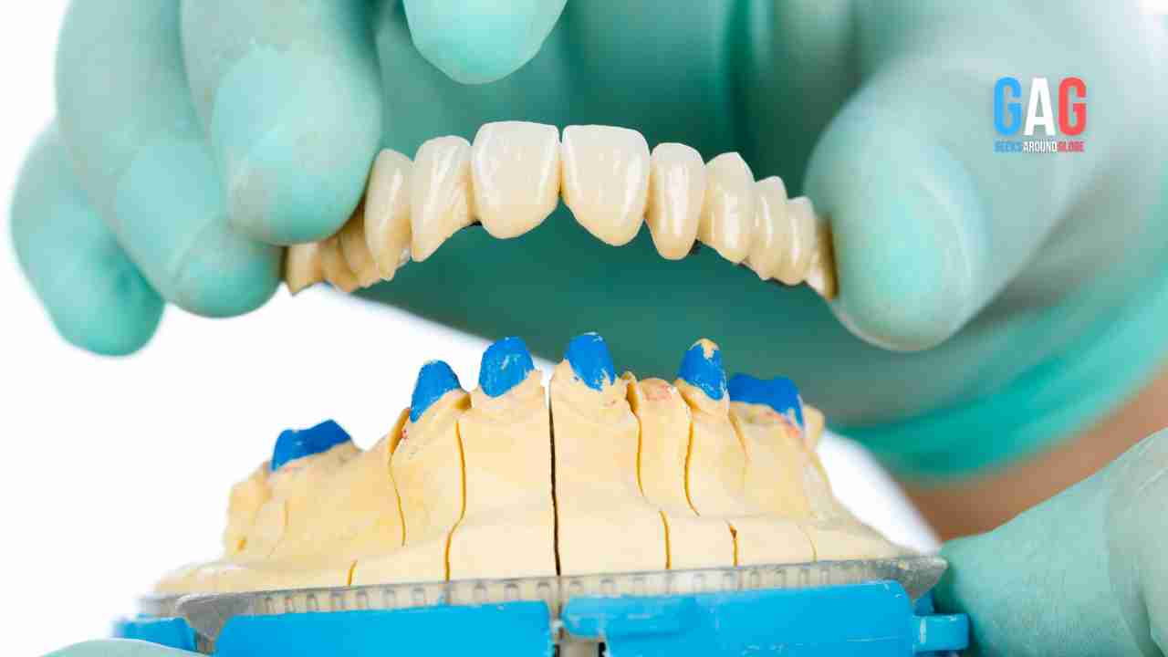 A Comprehensive Guide to Dental Porcelain Veneers