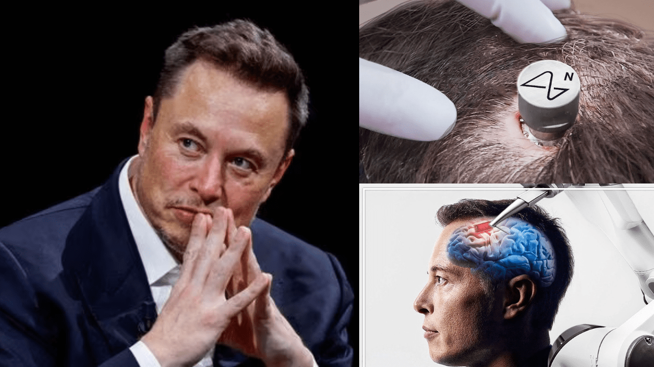Elon’s Neuralink Human Trials are ‘Life-threatening’ Says Medical Experts Implant Resulted in Deaths of Animals!