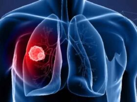 New Hope for Lung Cancer Patients | Tedopi Vaccine Reduces Death Risk by Nearly Half
