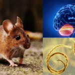 Rat-Borne Parasite Spreading In The U.S.A Can Cause Brain Disease!
