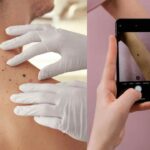 New AI Has 100% Detection Rate for Skin Cancers!