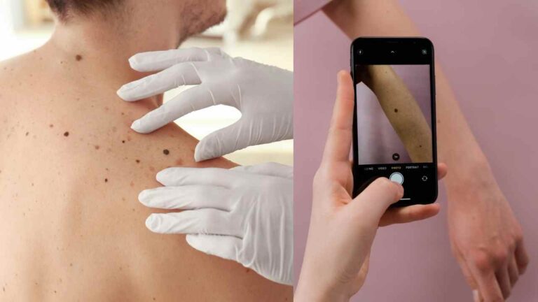 New AI Shows 100% Detection Rate for Skin Cancers!