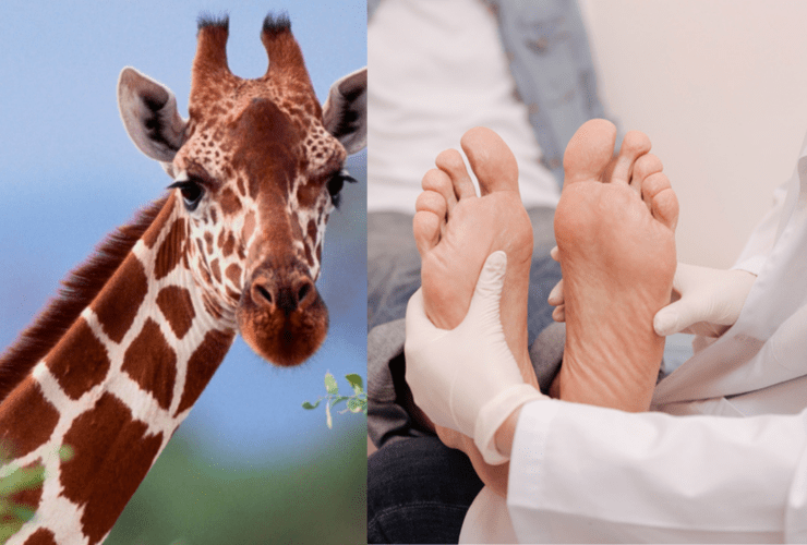 Scientists Use Giraffe Poop To Heal Diabetic Foot Infections!