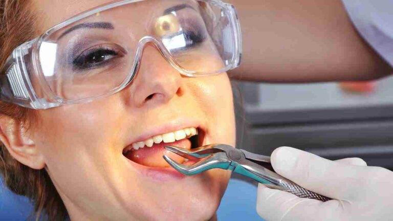 To Extract or Not to Extract: Deciding When it’s Time for a Tooth Extraction