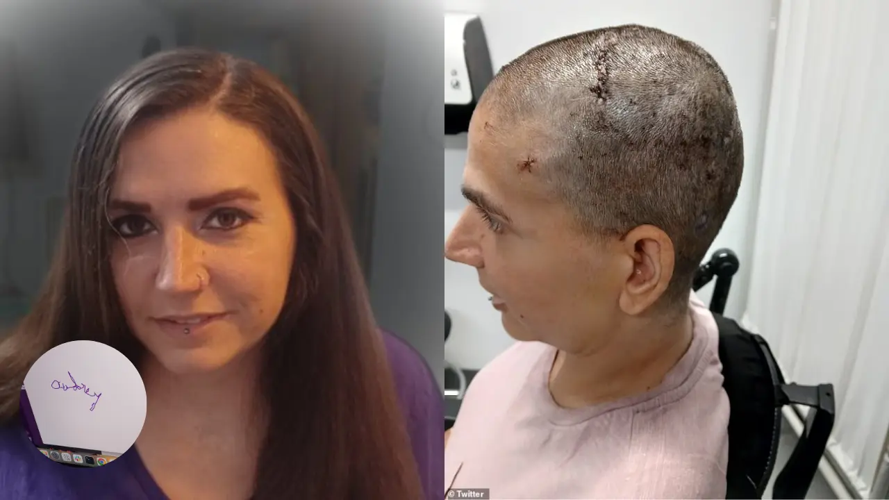 Neuralink Patient Writes Her Name After 20 Years Using Only Her Thoughts