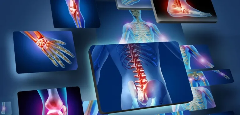 Musculoskeletal disorder treatments