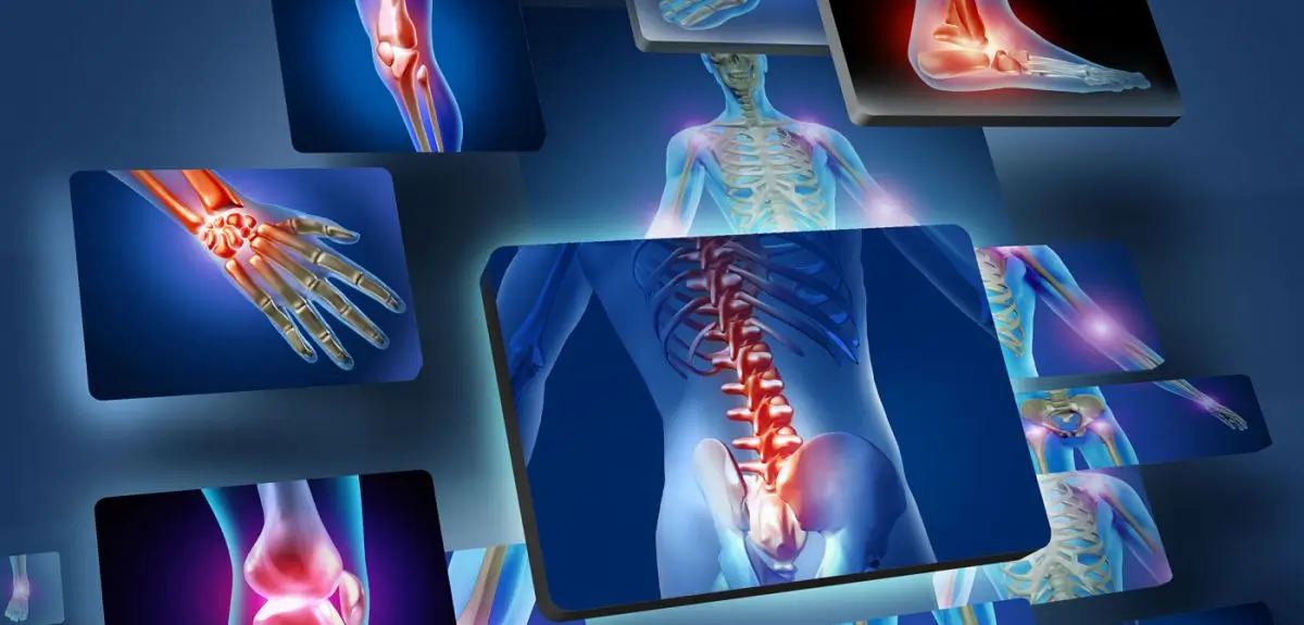 Musculoskeletal disorder treatments