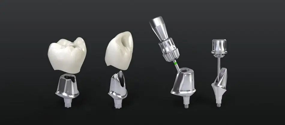 Abutment and prosthetic innovations